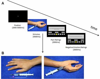 Placebo Effect on Modulating Empathic Pain: Reduced Activation in Posterior Insula